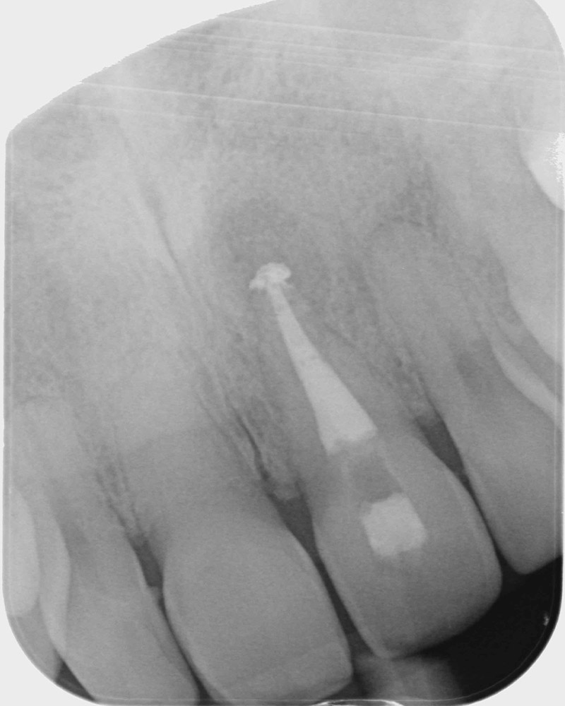 Endodontie